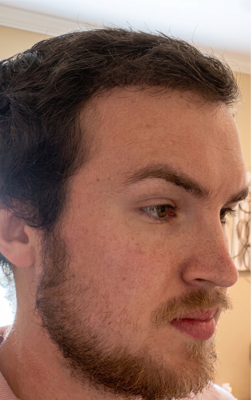 Avery β after, side profile