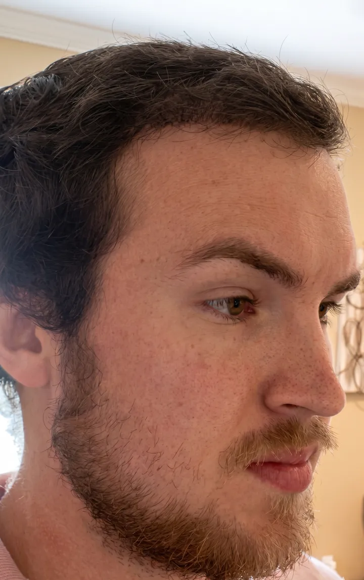 Avery β after, side profile