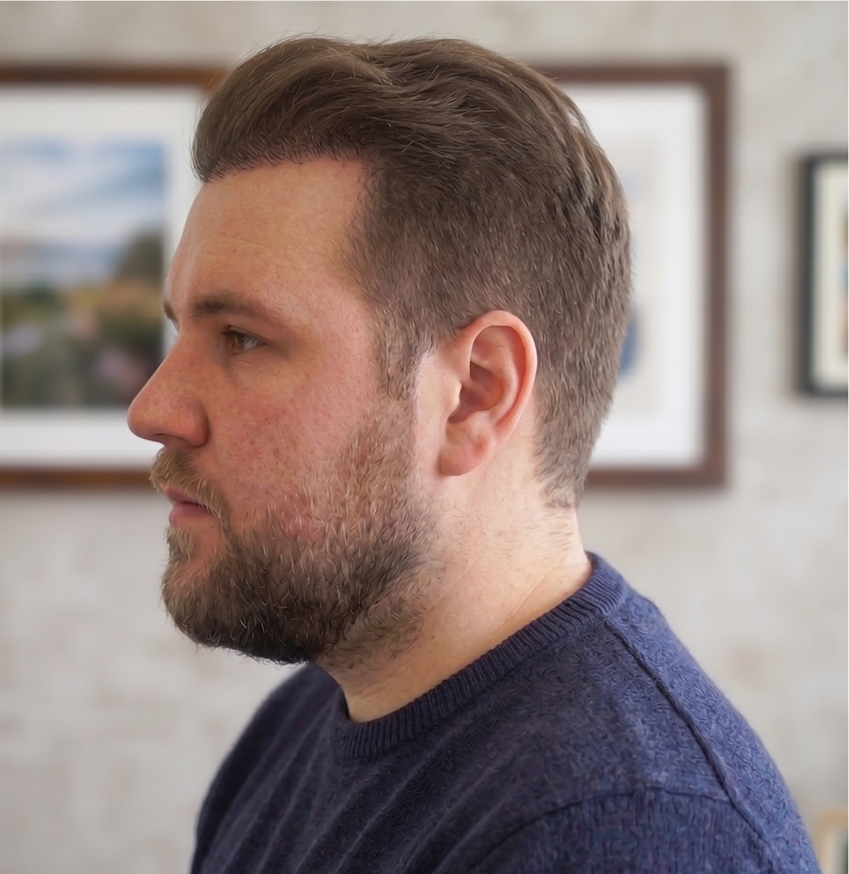 Chuck β after, side profile