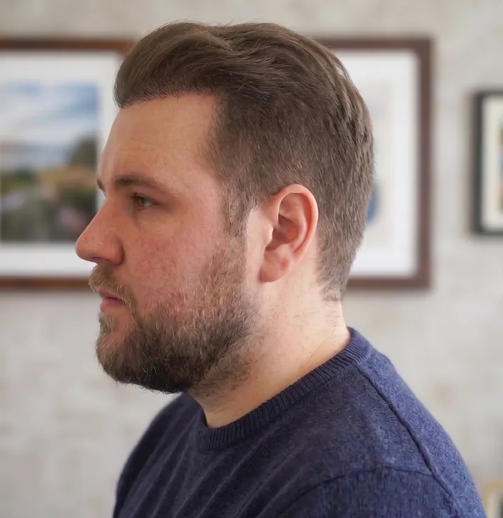 Chuck β after, side profile
