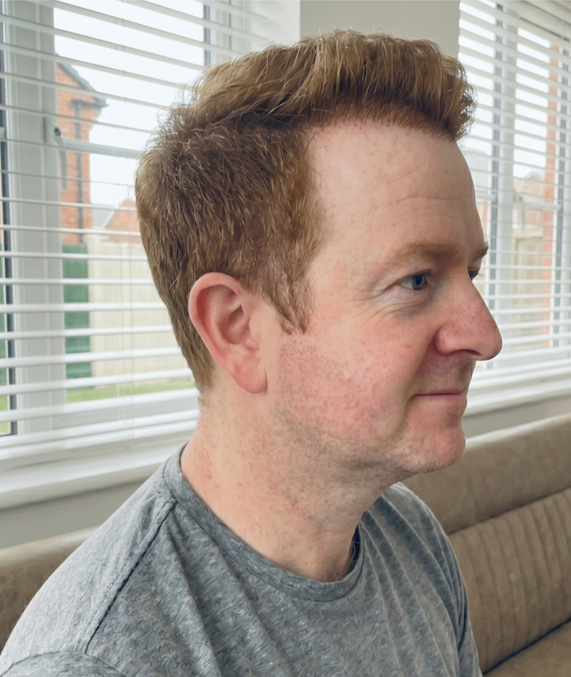 Craig β after, side profile
