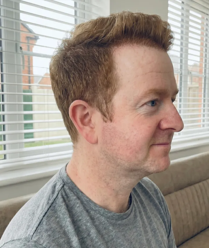 Craig β after, side profile