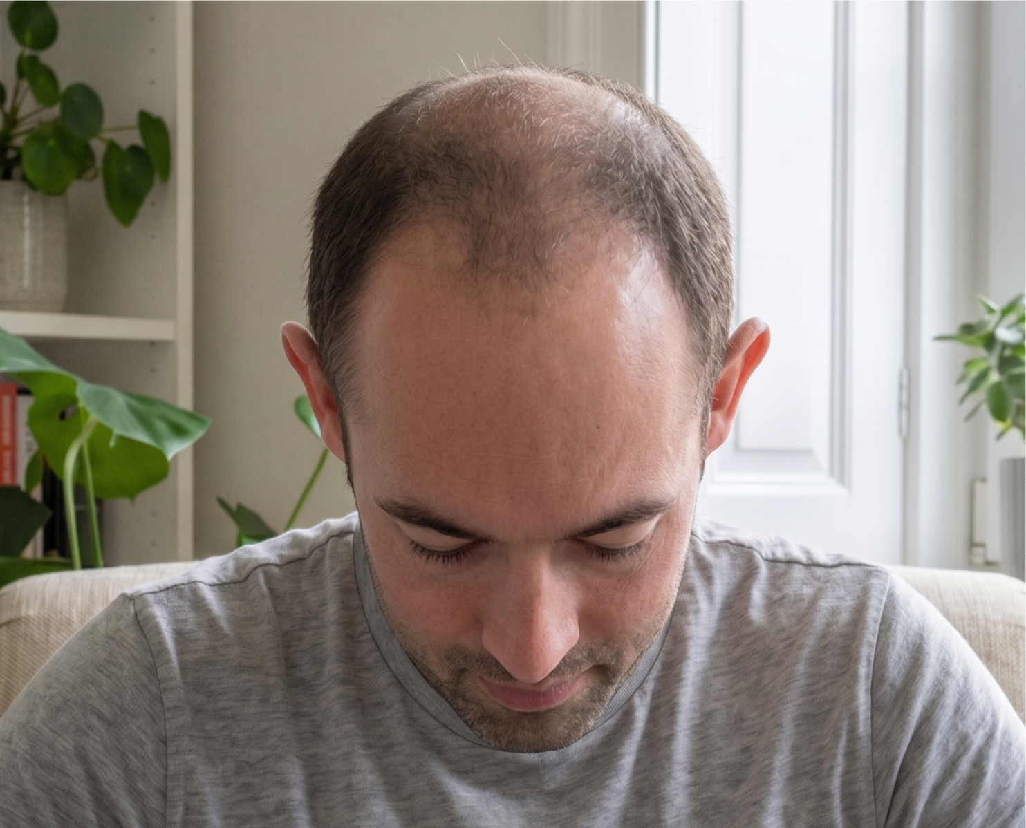 David β before, top view